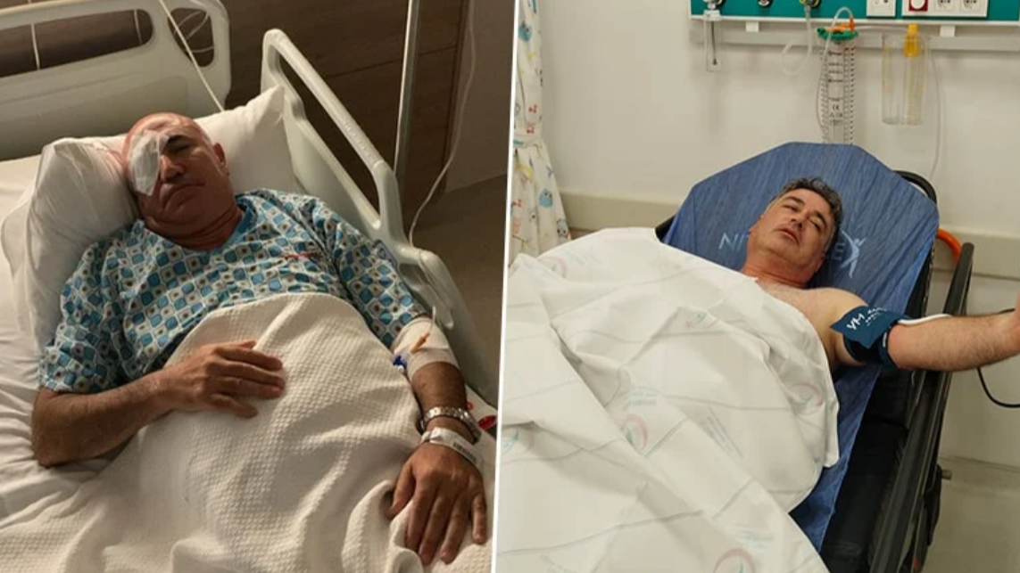 Mahmut Tanal, Polis Müdahalesinde Gözünden Yaralandı