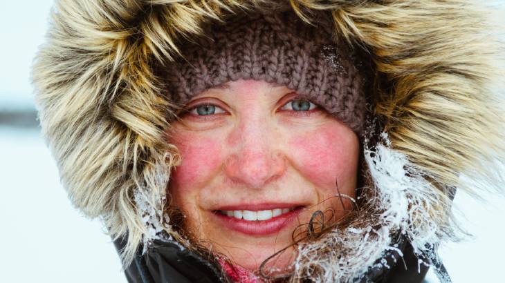 Uzmandan Kış Uyarısı: Çok Sıcak Duş Cildi Kurutuyor